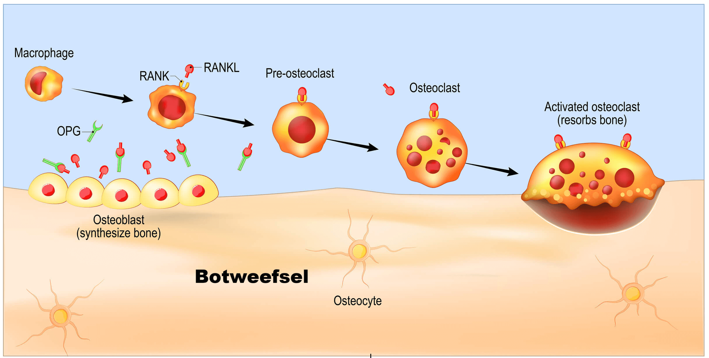 osteoporose