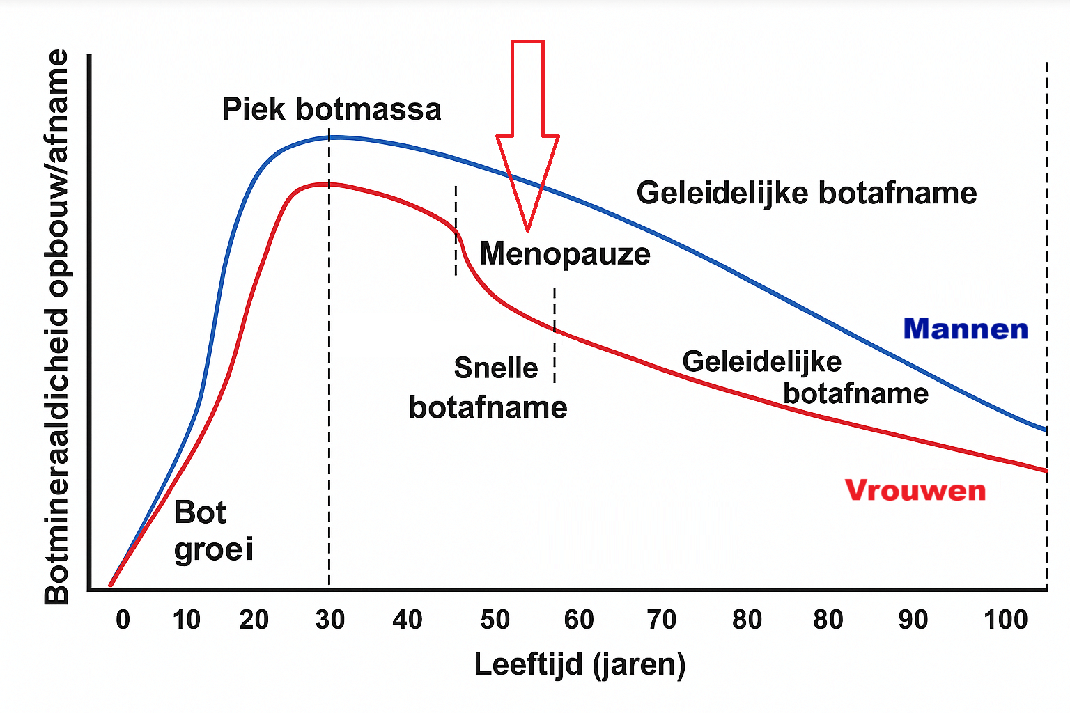 osteoporose