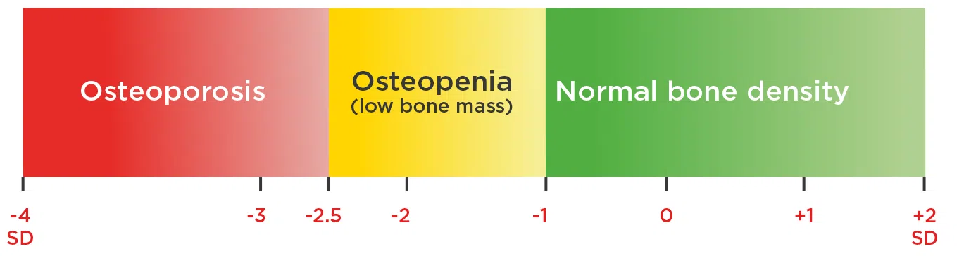 osteoporose